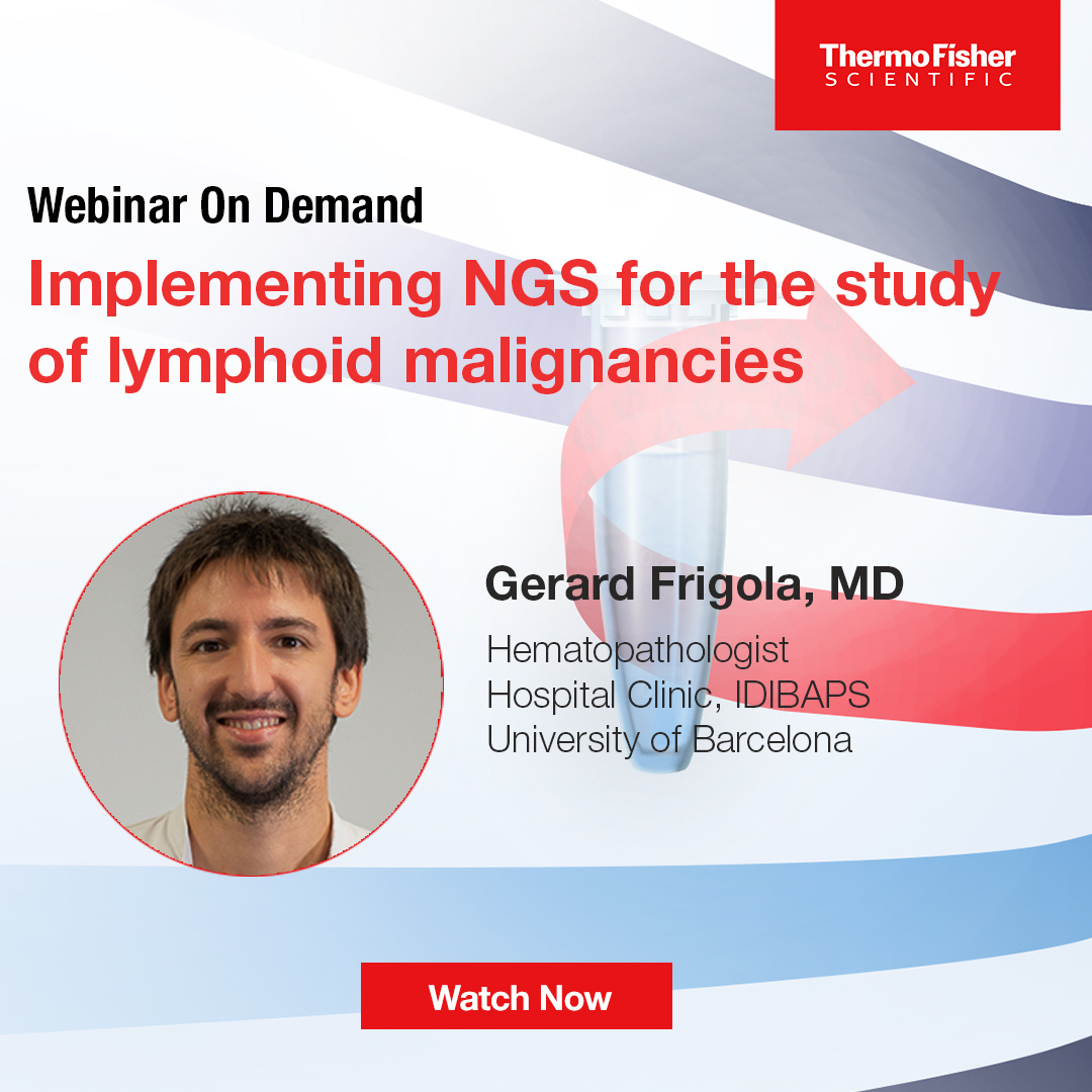 Implementing NGS for the Study of Lymphoid Malignancies