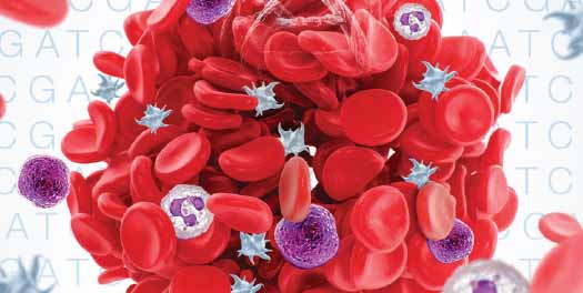 morlote-webinar-feature