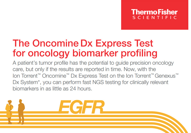 odxet-webinar-on-demand-resources-infographic