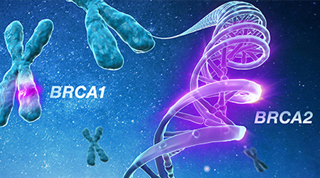 From BRCA to HRD testing in ovarian cancer