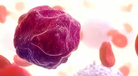 NGS: An emerging technique for MRD detection in acute myeloid leukemia